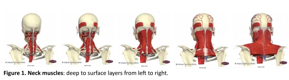 Figure 1. Neck muscles: deep to surface layers from left to right.